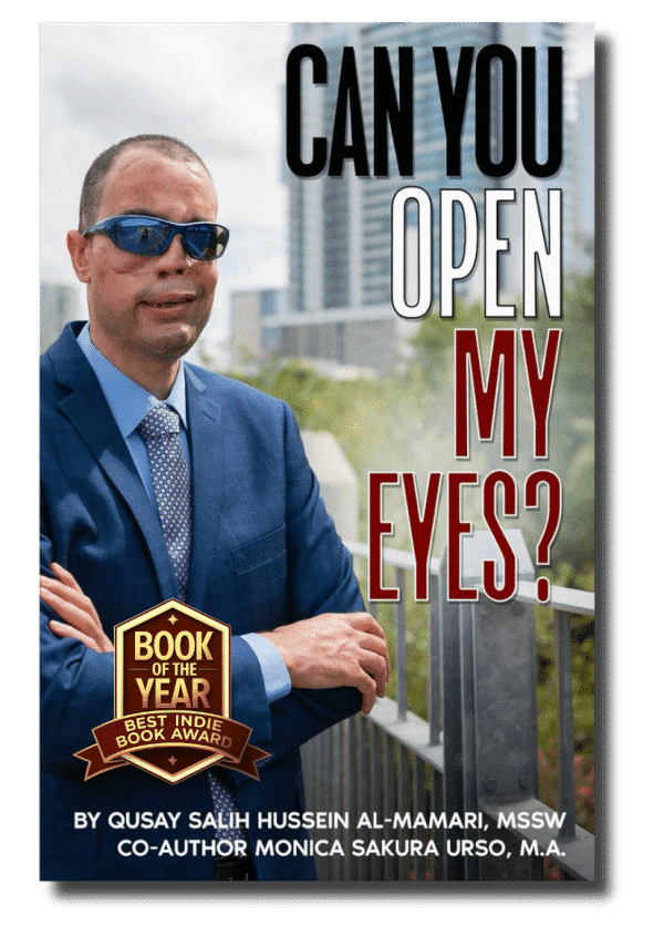 Can You Open My Eyes?